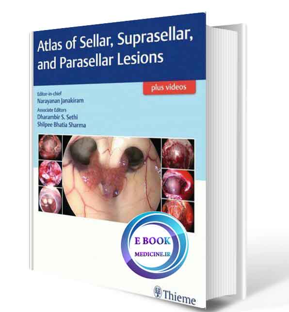 دانلود کتاب Atlas of Sellar, Suprasellar, and Parasellar Lesions 2019(ORIGINAL PDF)